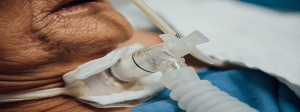 TBI Treatment in Altamonte Springs, FL, Atlanta, Alpharetta, Marietta and Surrounding Areas