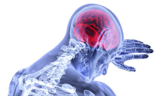 a graphic displaying head damage and requiring TBI Treatment in Atlanta, Marietta, GA, Douglasville, Alpharetta, DeKalb County